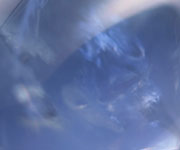 Iolite �A�C�I���C�g
